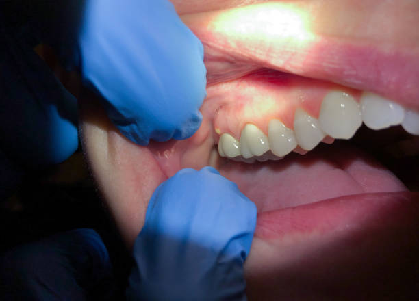 Best Emergency Care for Gum Disease in Myrtle Creek, OR